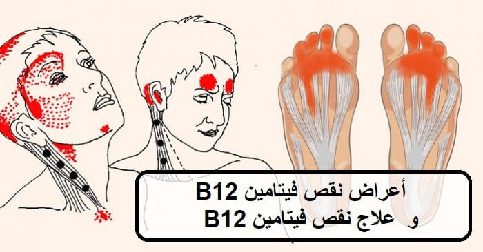 فيتامين ب12
