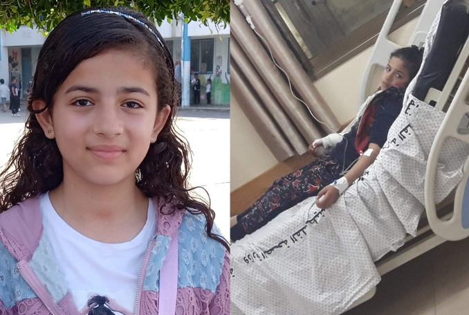 أصيبت يارا الغوطي برصاص البحرية الإسرائيلية أثناء تواجدها على شاطئ رفح.
