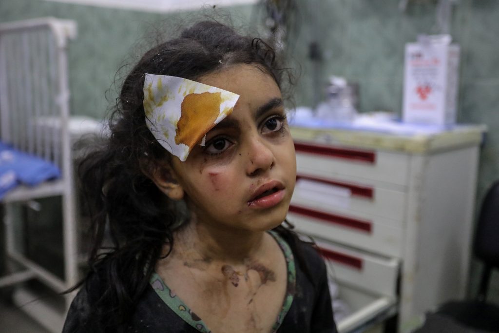 فلسطينية مصابة أثناء نقلها إلى المستشفى في أعقاب غارات جوية إسرائيلية على رفح ، جنوب قطاع غزة ، في 6 أغسطس ، 2022.
